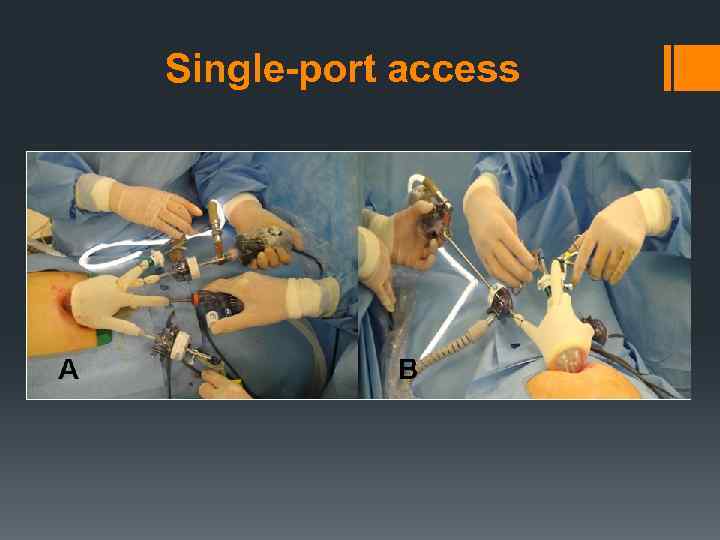 Single-port access 