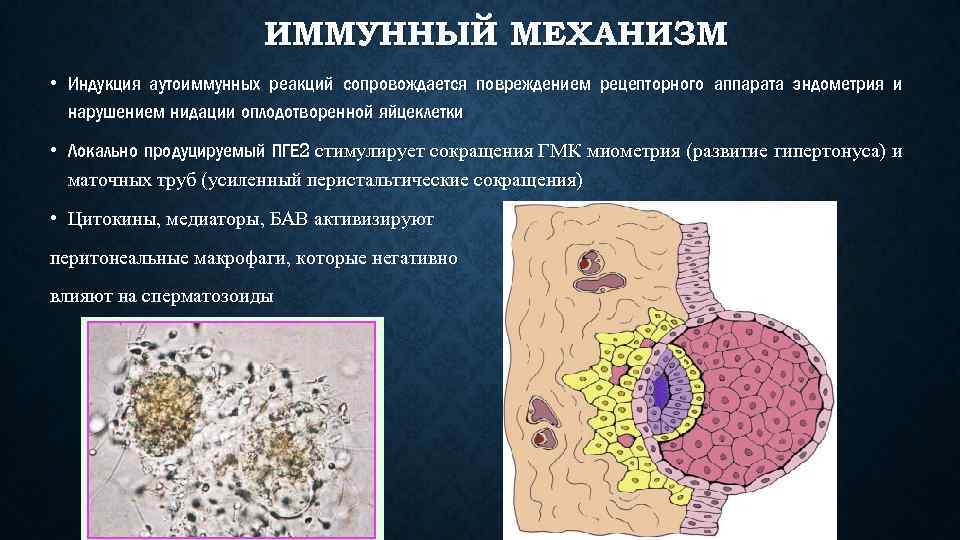 ИММУННЫЙ МЕХАНИЗМ • Индукция аутоиммунных реакций сопровождается повреждением рецепторного аппарата эндометрия и нарушением нидации