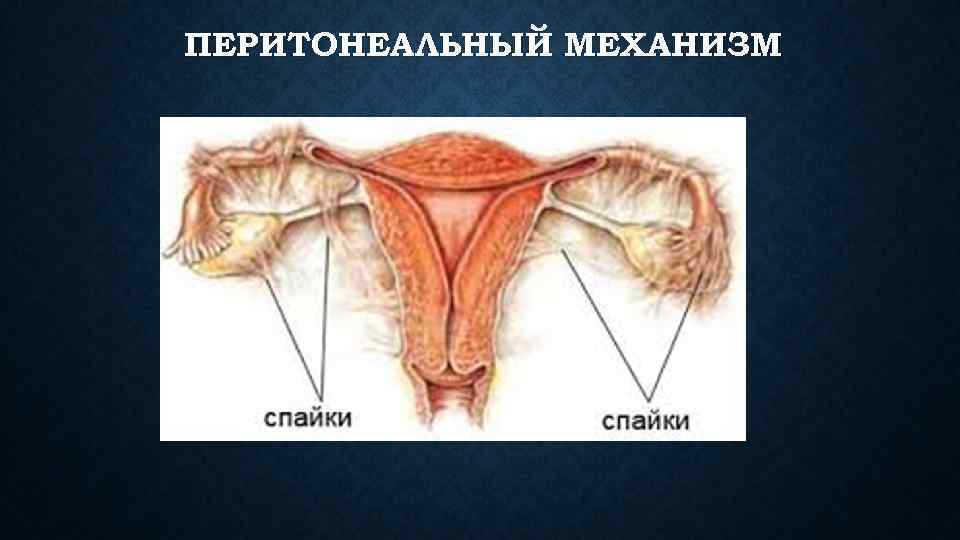 ПЕРИТОНЕАЛЬНЫЙ МЕХАНИЗМ 