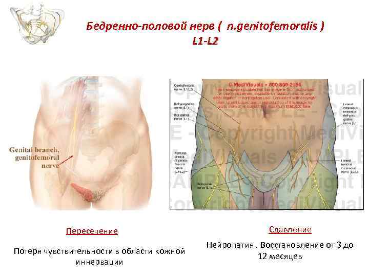 Бедренно-половой нерв ( n. genitofemoralis ) L 1 -L 2 Пересечение Потеря чувствительности в