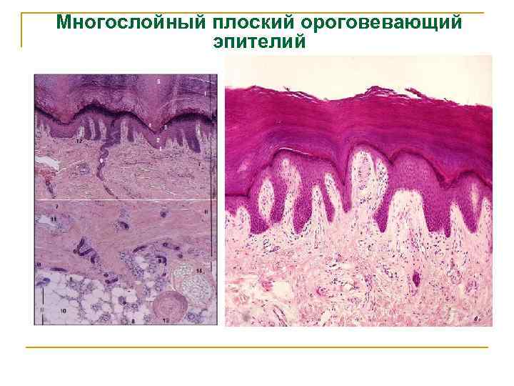 Многослойный плоский ороговевающий эпителий 