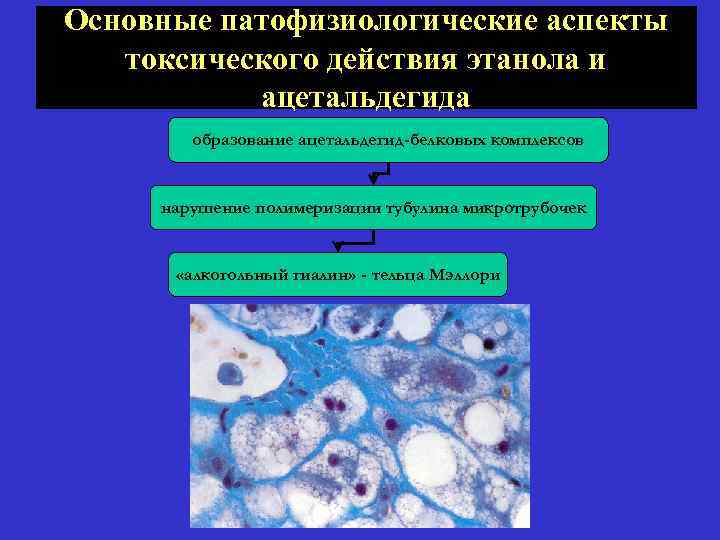 Основные патофизиологические аспекты токсического действия этанола и ацетальдегида образование ацетальдегид-белковых комплексов нарушение полимеризации тубулина