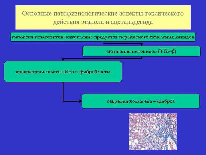 Основные патофизиологические аспекты токсического действия этанола и ацетальдегида гипоксия гепатоцитов, накопление продуктов перекисного окисления