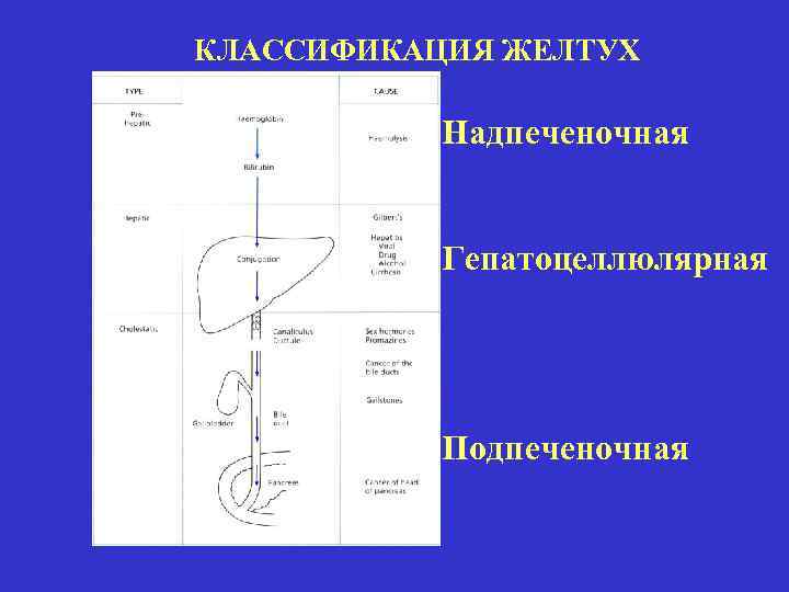 Подпеченочная желтуха схема