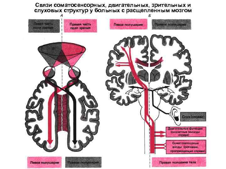 Связи соматосенсорных, двигательных, зрительных и слуховых структур у больных с расщепленным мозгом 