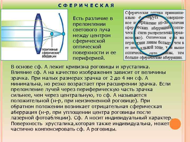 СФЕРИЧЕСКАЯ Есть различие в преломлении светового луча между центром сферической оптической поверхности и ее