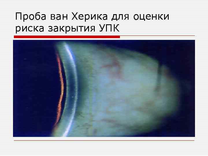 Проба ван Херика для оценки риска закрытия УПК 