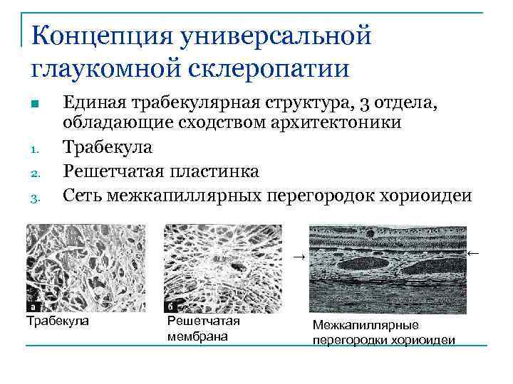 Концепция универсальной глаукомной склеропатии n 1. 2. 3. Единая трабекулярная структура, 3 отдела, обладающие