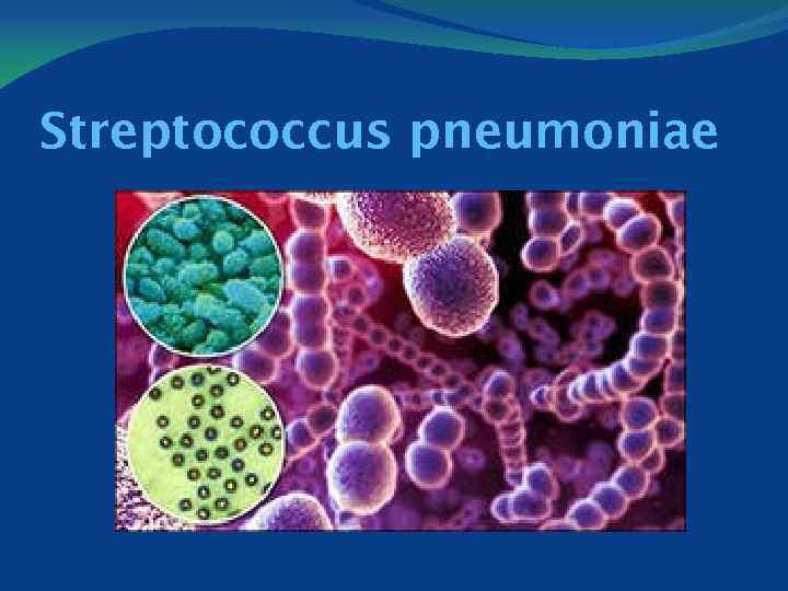 Streptococcus pneumoniae 