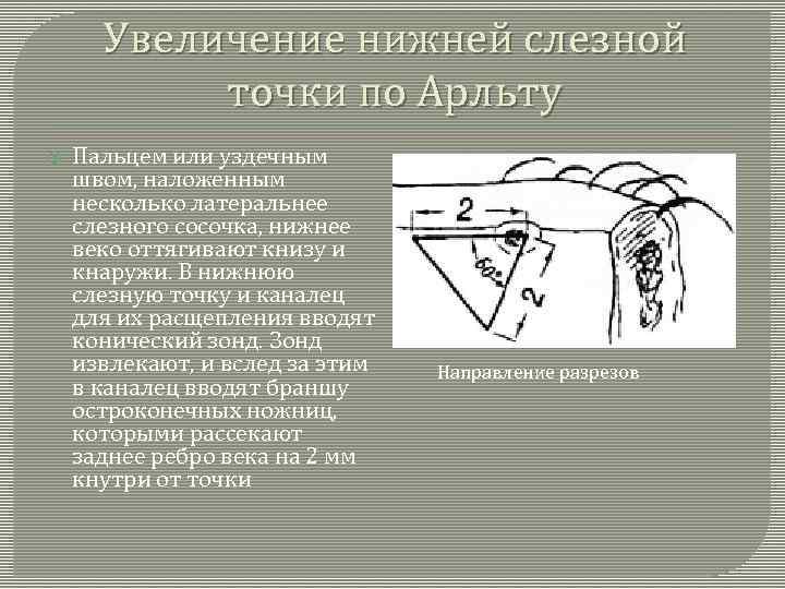 Увеличение нижней слезной точки по Арльту Пальцем или уздечным швом, наложенным несколько латеральнее слезного