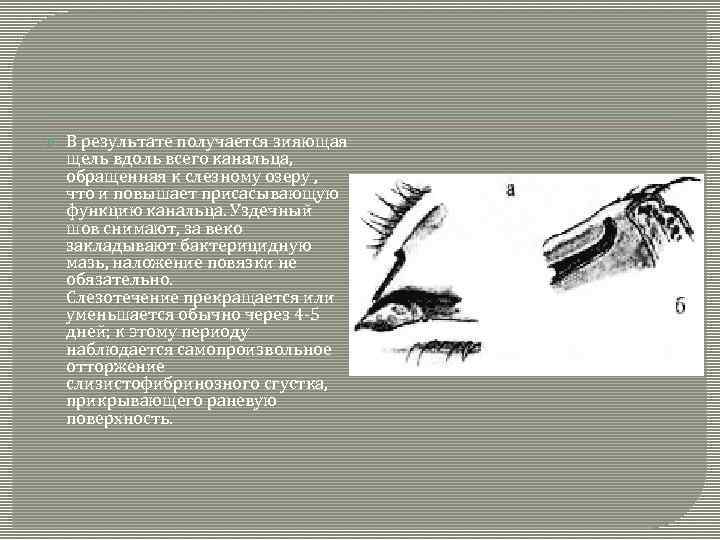  В результате получается зияющая щель вдоль всего канальца, обращенная к слезному озеру ,