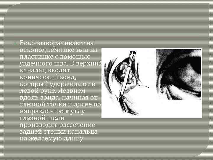  Веко выворачивают на векоподъемнике или на пластинке с помощью уздечного шва. В верхний
