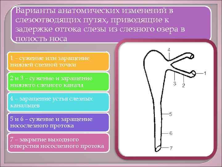 Варианты анатомических изменений в слезоотводящих путях, приводящие к задержке оттока слезы из слезного озера