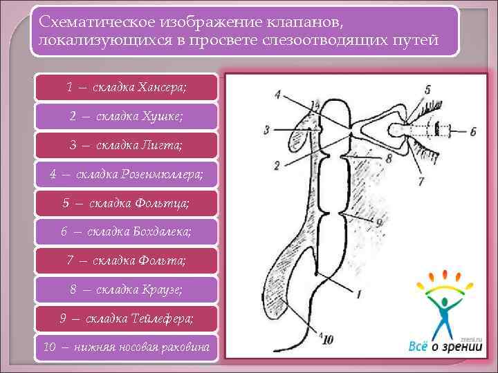 Схематическое изображение клапанов, локализующихся в просвете слезоотводящих путей 1 — складка Хансера; 2 —