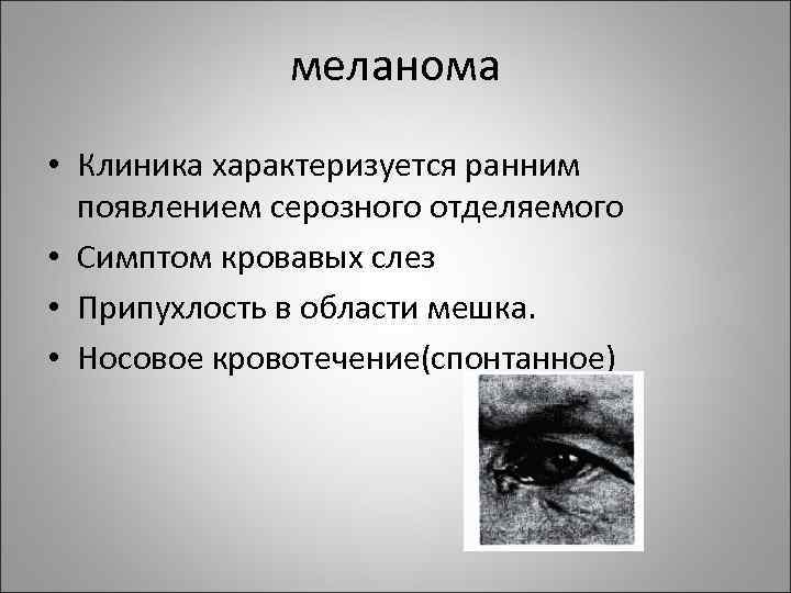 меланома • Клиника характеризуется ранним появлением серозного отделяемого • Симптом кровавых слез • Припухлость