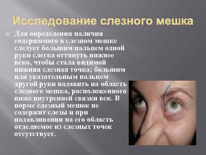 Исследование слезного мешка Для определения наличия содержимого в слезном мешке следует большим пальцем одной