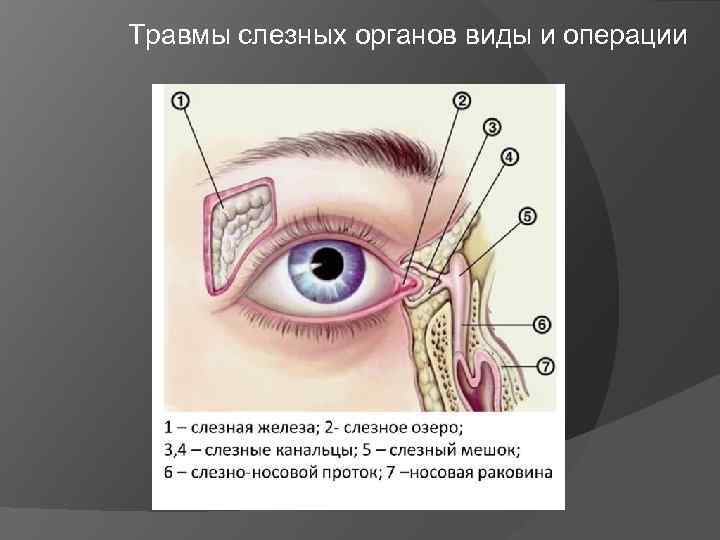 Травмы слезных органов виды и операции 