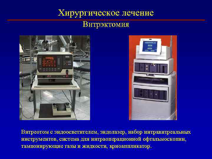 Хирургическое лечение Витрэктомия Витреотом с эндоосветителем, эндолазер, набор интравитреальных инструментов, система для интраоперационной офтальмоскопии,