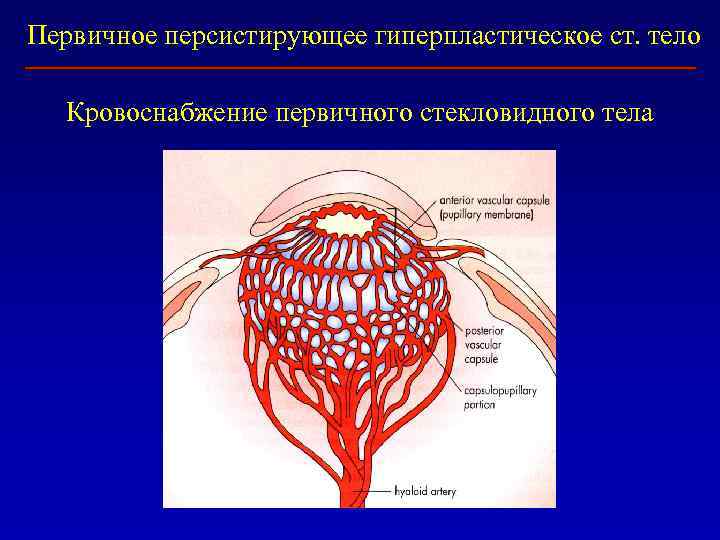 Первичное персистирующее гиперпластическое ст. тело Кровоснабжение первичного стекловидного тела 