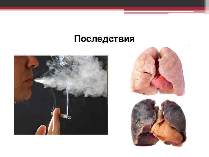 Последствия 
