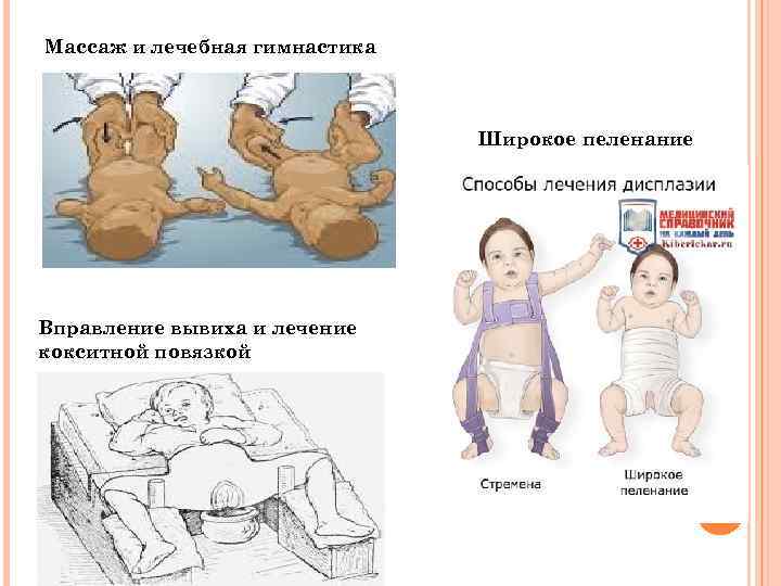 Массаж и лечебная гимнастика Широкое пеленание Вправление вывиха и лечение кокситной повязкой 