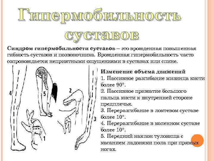 Гипермобильность суставов Синдром гипермобильности суставов – это врожденная повышенная гибкость суставов и позвоночника. Врожденная