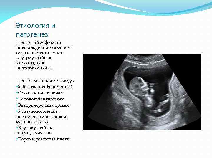 Этиология и патогенез Причиной асфиксии новорожденного является острая и хроническая внутриутробная кислородная недостаточность. Причины