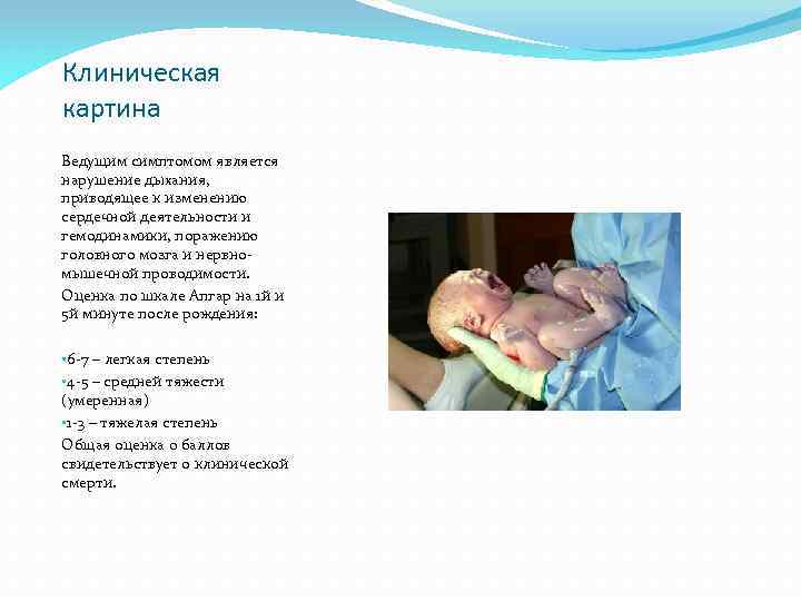 Клиническая картина Ведущим симптомом является нарушение дыхания, приводящее к изменению сердечной деятельности и гемодинамики,