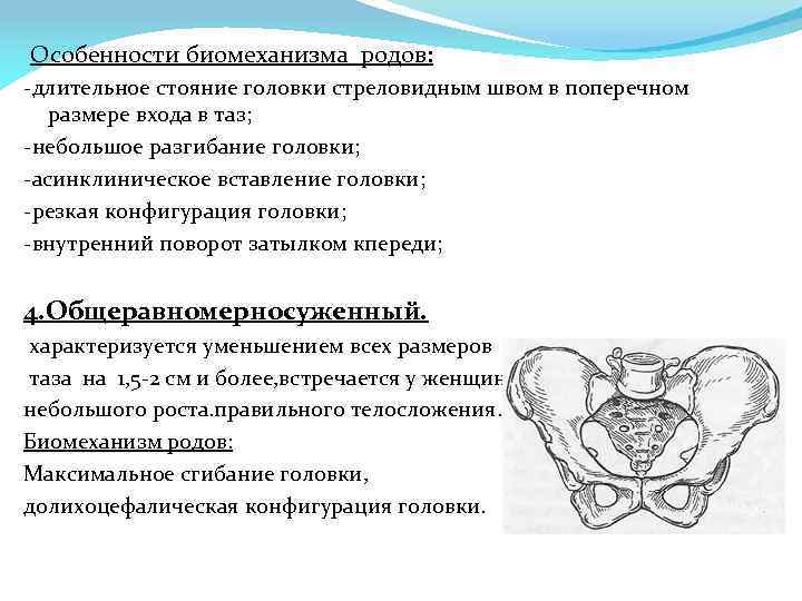 Презентация аномалии костного таза