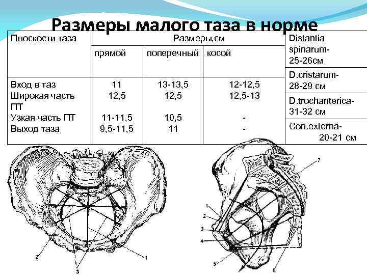 Диаметр плоскости. Размеры малого таза в акушерстве. Размере плоскости входа малого таза. Прямой размер плоскости входа в малый таз. Левый косой размер плоскости входа в малый таз.