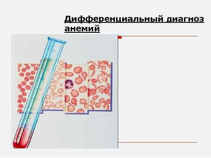 Дифференциальный диагноз анемий 