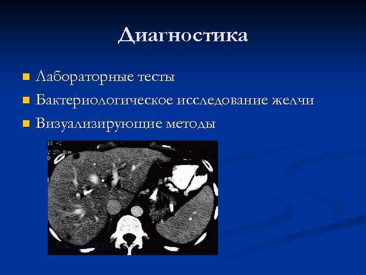 Диагностика Лабораторные тесты n Бактериологическое исследование желчи n Визуализирующие методы n 