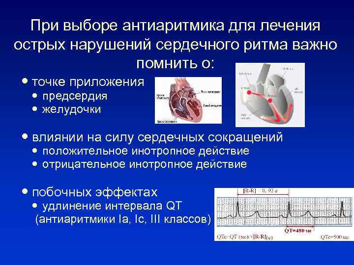 При выборе антиаритмика для лечения острых нарушений сердечного ритма важно помнить о: точке приложения