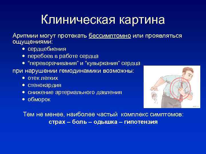 Клиническая картина Аритмии могут протекать бессимптомно или проявляться ощущениями: сердцебиения перебоев в работе сердца