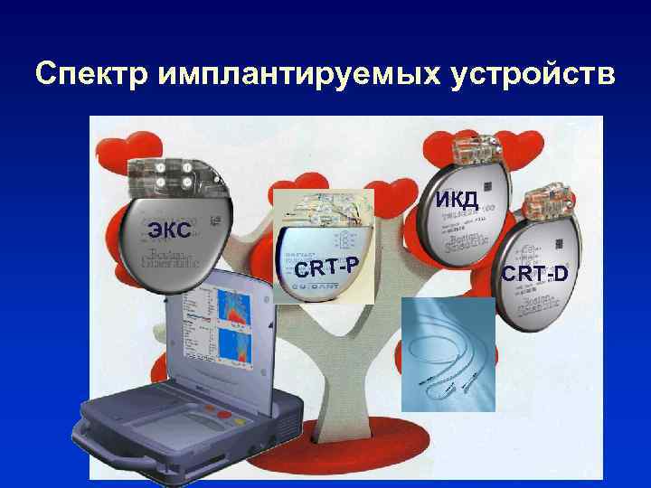 Спектр имплантируемых устройств ИКД ЭКС CRT-P CRT-D 