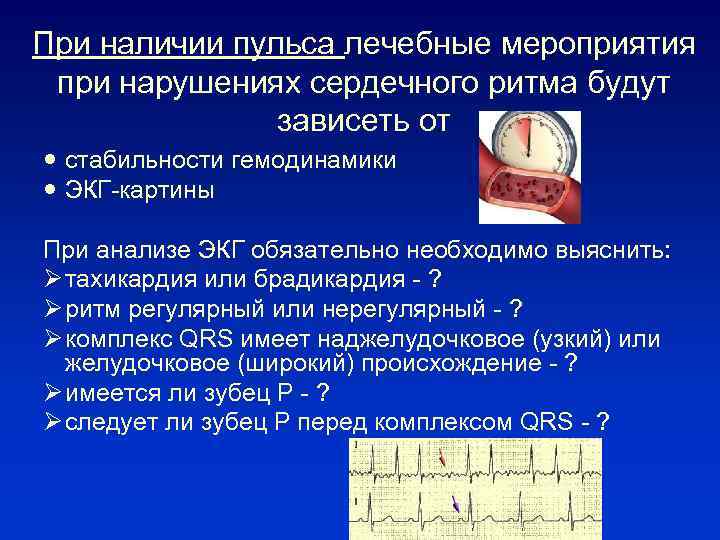 При наличии пульса лечебные мероприятия при нарушениях сердечного ритма будут зависеть от стабильности гемодинамики