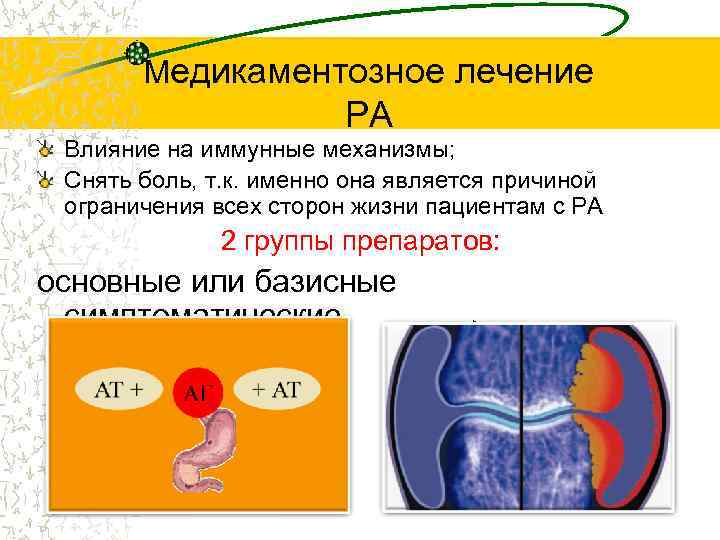Медикаментозное лечение РА Влияние на иммунные механизмы; Снять боль, т. к. именно она является
