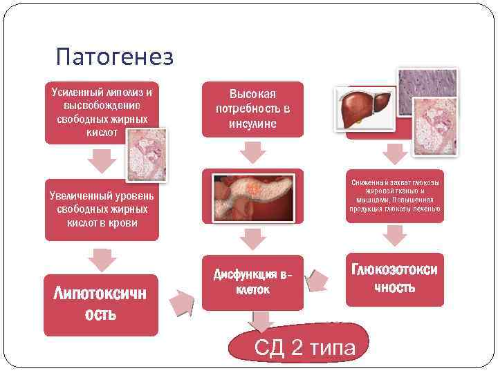 Патогенез Усиленный липолиз и высвобождение свободных жирных кислот Высокая потребность в инсулине Сниженный захват