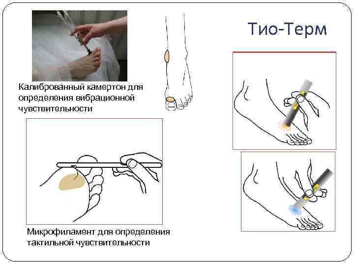  Тио-Терм Калиброванный камертон для определения вибрационной чувствительности Микрофиламент для определения тактильной чувствительности 