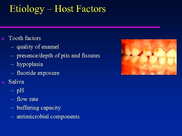 Etiology – Host Factors u u Tooth factors – quality of enamel – presence/depth