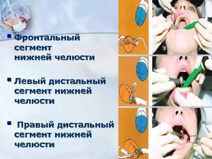 § Фронтальный сегмент нижней челюсти § Левый дистальный сегмент нижней челюсти § Правый дистальный