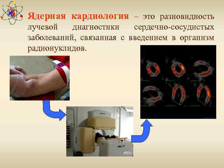 Ядерная кардиология – это разновидность лучевой диагностики сердечно-сосудистых заболеваний, связанная с введением в организм