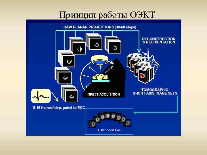 Принцип работы ОЭКТ 