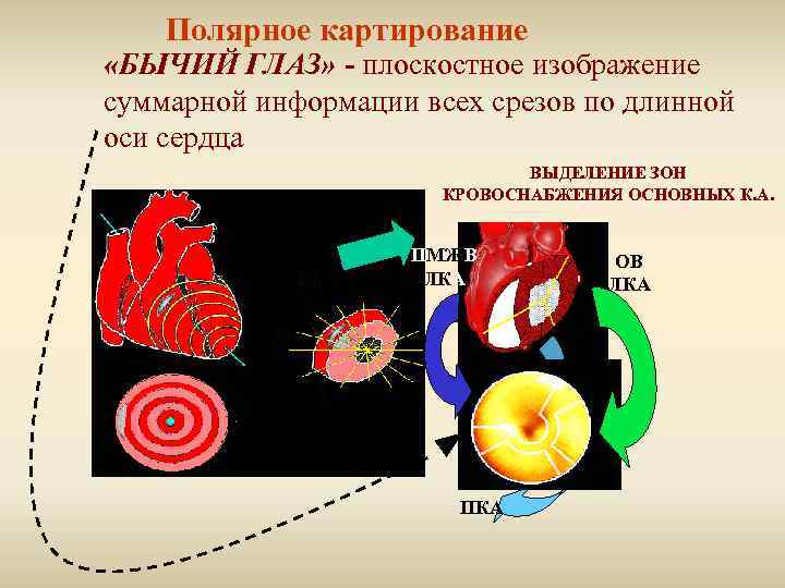 Полярное картирование «БЫЧИЙ ГЛАЗ» - плоскостное изображение суммарной информации всех срезов по длинной оси