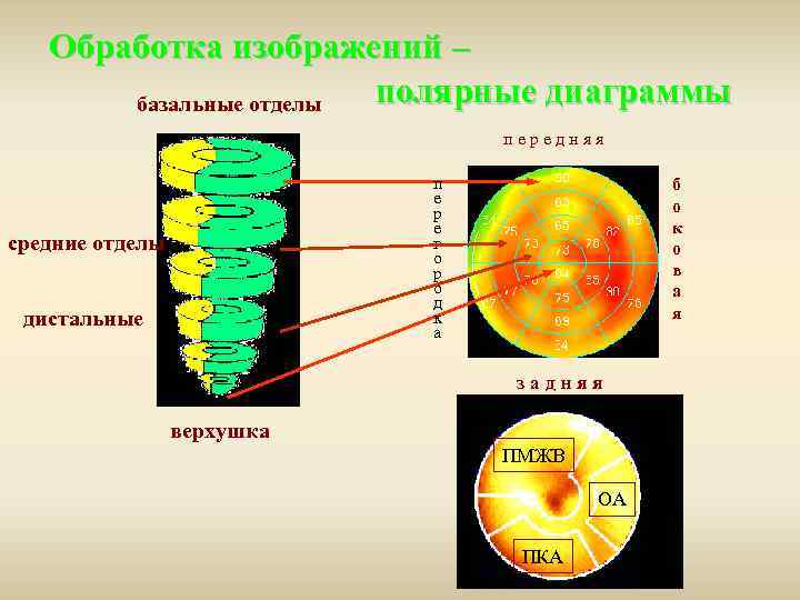 Обработка изображений – полярные диаграммы базальные отделы передняя п е р е г о