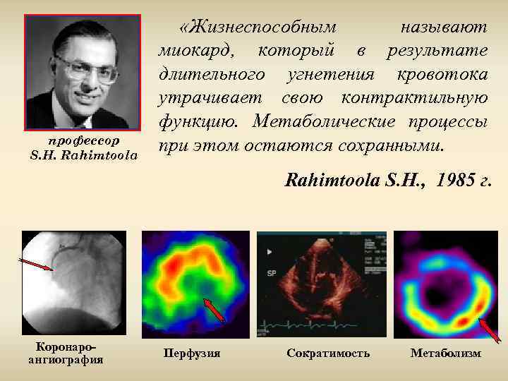 профессор S. Н. Rahimtoola «Жизнеспособным называют миокард, который в результате длительного угнетения кровотока утрачивает