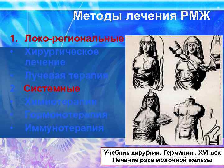 Методы лечения РМЖ 1. Локо-региональные • Хирургическое лечение • Лучевая терапия 2. Системные •