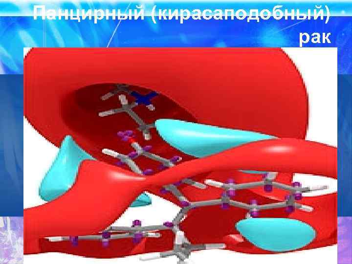 Панцирный (кирасаподобный) рак 