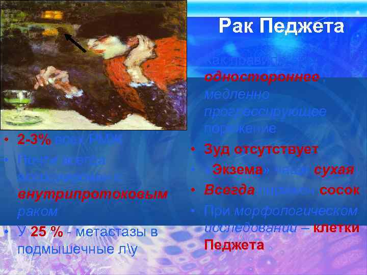 Рак Педжета • 2 -3% всех РМЖ • Почти всегда ассоциирован с внутрипротоковым раком