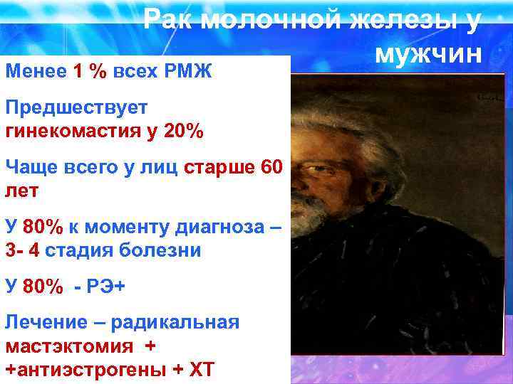 Рак молочной железы у мужчин Менее 1 % всех РМЖ Предшествует гинекомастия у 20%